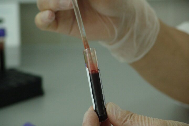 Blood 20745 1280